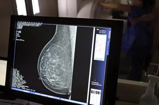 Nova lei garante três folgas anuais para exames preventivos